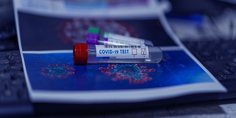 Eurobio Scientific Introduces New Covid 19 RT PCR Test