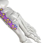 Proteor launches SYNSYS full-leg system for triple flexion movements -  GlobalData