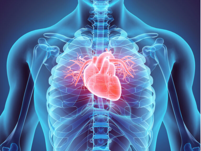 Mechanical hyperventilation could improve cardiac radiotherapy