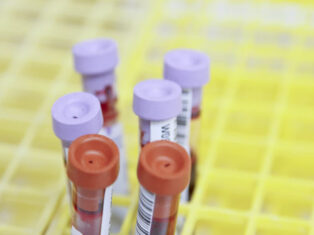 BD And BioMedomics Roll Out Blood Test To Detect Covid-19 Exposure