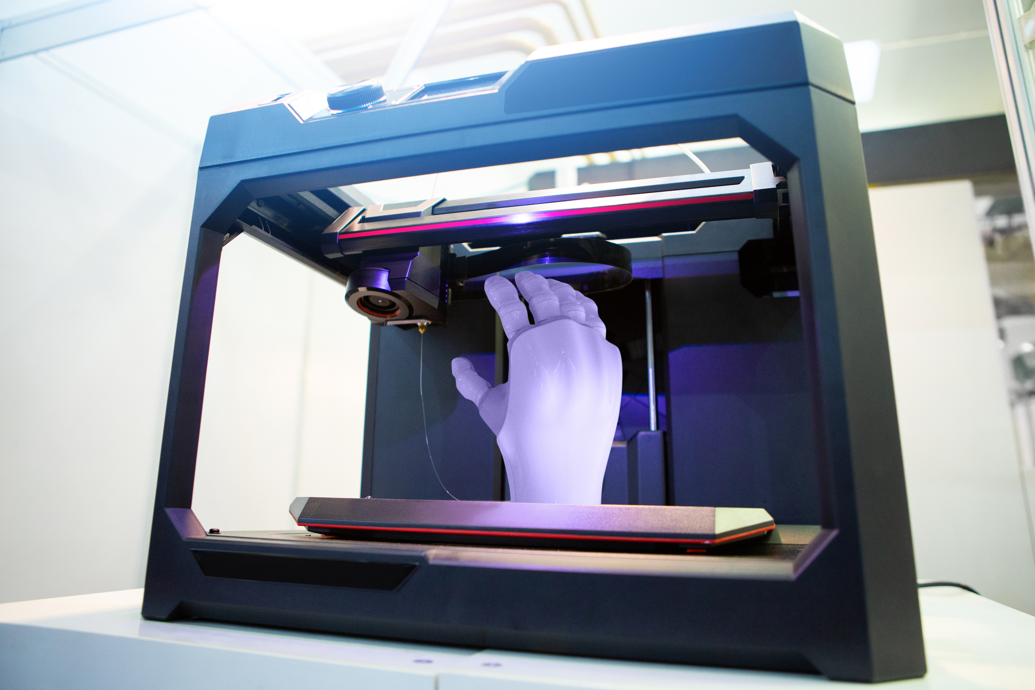 3d printed prosthetics