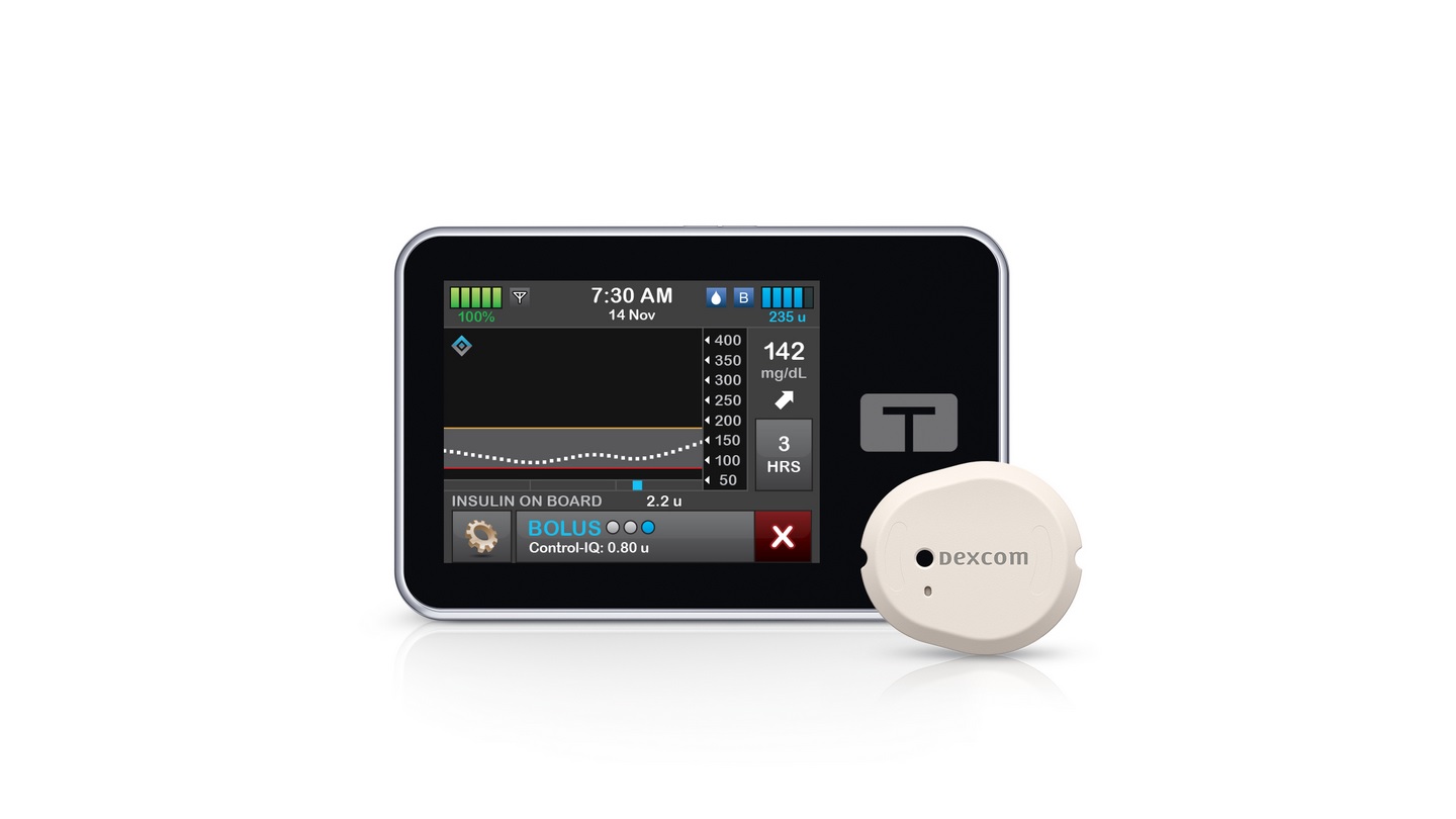 Tandem introduces updated t:slim X2 insulin pump software