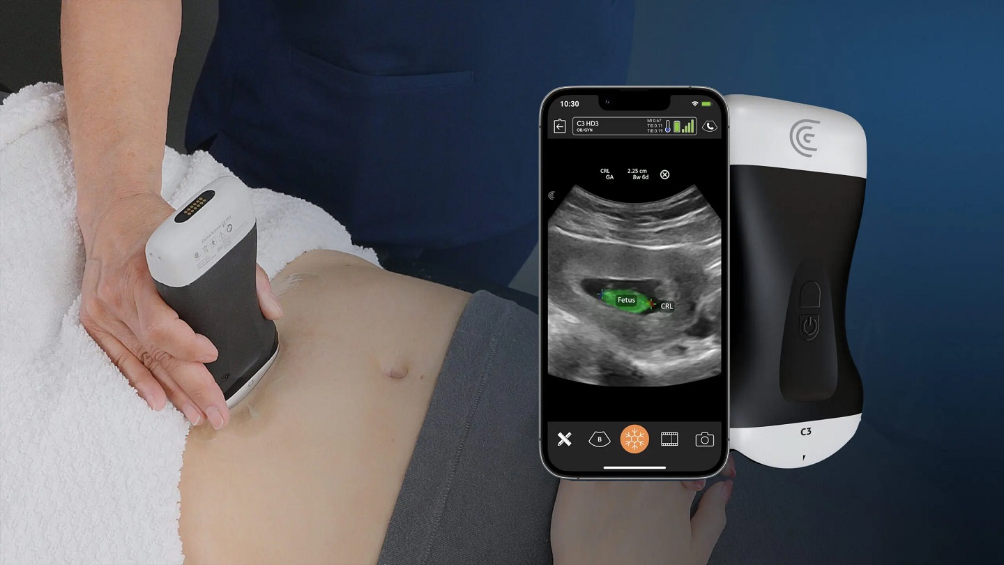 Clarius’ OB AI tool for handheld ultrasound secures FDA approval