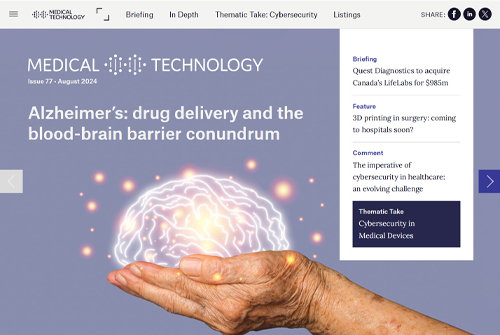 Alzheimer’s: drug delivery and the blood-brain barrier conundrum Digimags