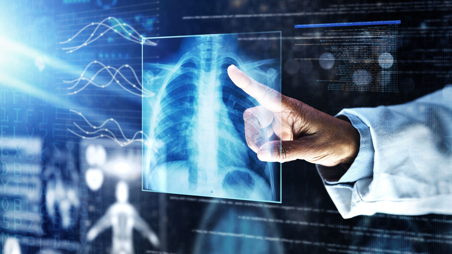 Invenio completes enrolment in AI-based lung cancer imaging trial ...