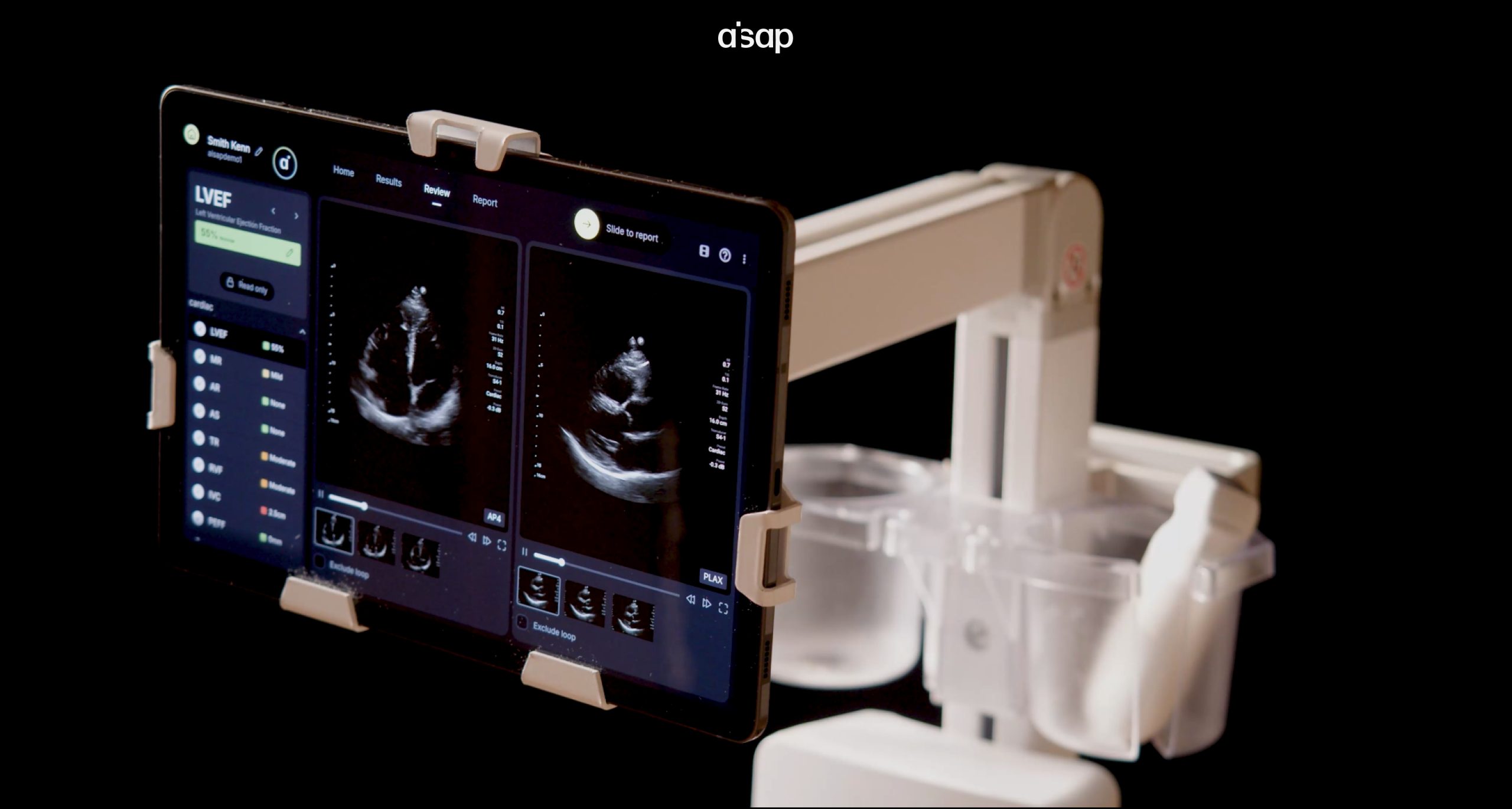 AISAP and Amavita partner to bring POCUS to underserved Floridian communities