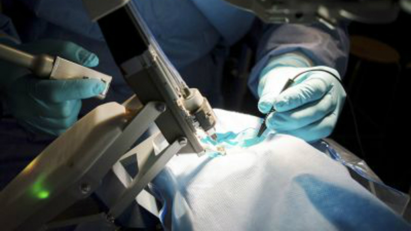 Robotic system for eye surgery